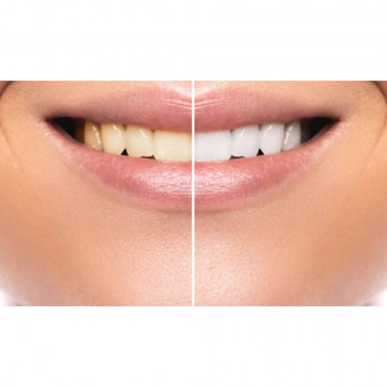 Apa de Gura Colgate Plax Cool Mint, Fara Alcool, 500 ml, Aroma Menta, Apa de Gura Colgate, Apa de Gura Mentolata, Produse Ingrijire Dentara, Ingrijire Orala, Produse pentru Sanatate Dentara, Ingrijire si Protectie Dentara
